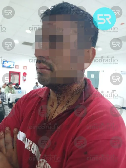 Violencia nocturna: Familia de comerciantes golpeada por vecinos en Colonia Villa Frontera